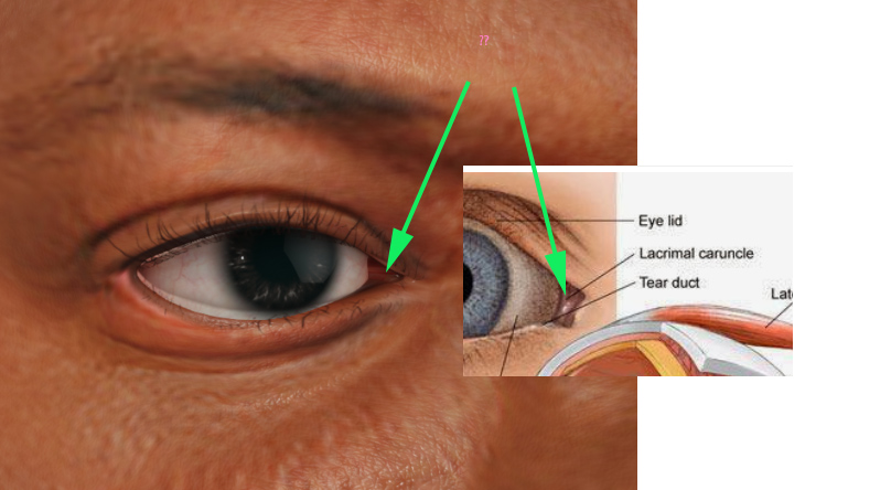 lacrimal caruncle